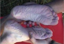 Les pieds du raideur